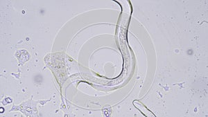 Nematode or roundworm.