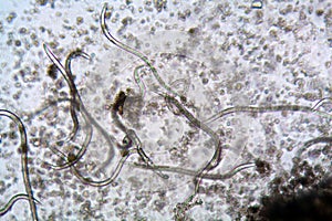 The nematode Steinernema feltiae under the microscope
