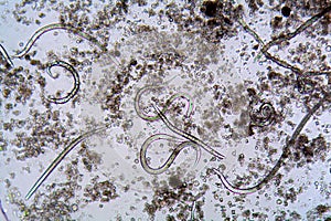 The nematode Steinernema feltiae under the microscope