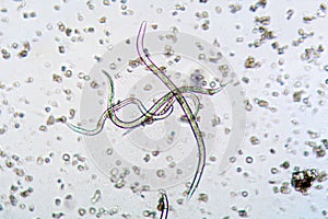 The nematode Steinernema feltiae under the microscope