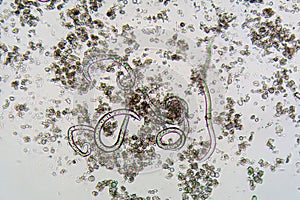 The nematode Steinernema feltiae under the microscope