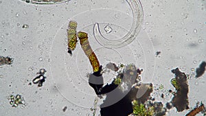 Nematode worm close-up between bacteria and algae looking for food