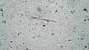 The nematode worm moves among numerous clusters of bacteria and microorganisms