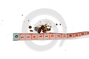 Nephrolithiasis, irregular brown kidney stones (renal calculus or nephrolith), the stones are different in size