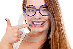 Nerdy woman showing her teeth with braces