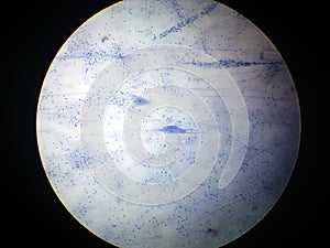 Nerve cell