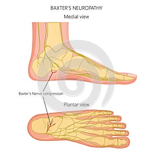 Nerves of the foot-02