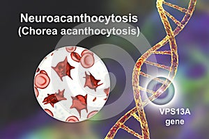 Neuroacanthocytosis, or Chorea acanthocytosis, a neurodegenerative disease, conceptual 3D illustration