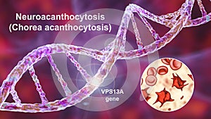 Neuroacanthocytosis, or Chorea acanthocytosis, a neurodegenerative disease, conceptual 3D illustration