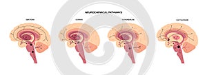 Neurochemical pathway diagram photo