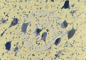 Neurocytes with processes. Cell structure of nervous tissue