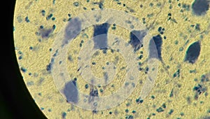 Neurocytes with processes. Cell structure of nervous tissue