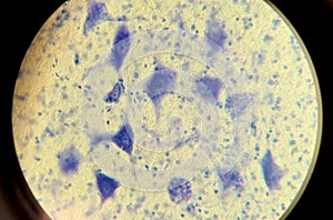 Neurocytes with processes. Cell structure of nervous tissue