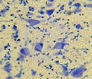 Neurocytes with processes. Cell structure of nervous tissue