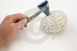 A neurologist, holding a neurological hammer, conducts examinations of the brain. The idea for the examination of the patient or a photo