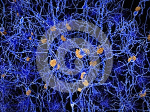 Neuron network with amyloid plaques photo