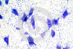 Neurons cells from the brain under the microscope view