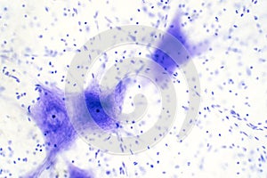 Neurons cells from the brain under the microscope view