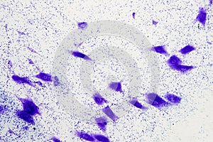 Neurons cells from the brain under microscope view