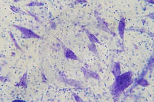 Neurons cells from the brain under the microscope view