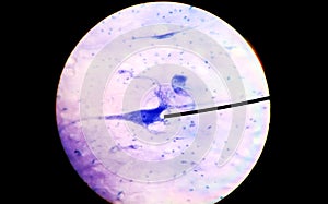 Neurons cells from medulla.