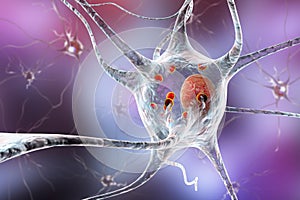 Neurons in Parkinson& x27;s disease