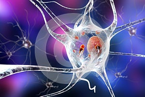 Neurons in Parkinson& x27;s disease