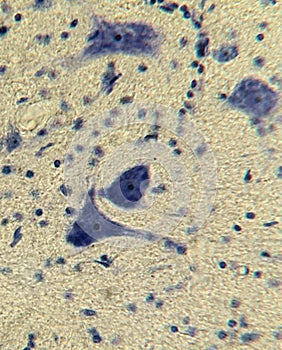 Neurocytes with processes. Cell structure of nervous tissue photo