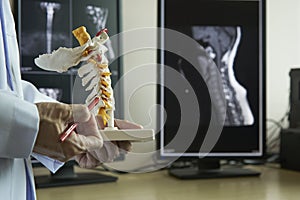 A neurosurgeon pointing at cervical spine model photo