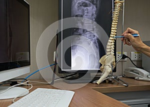 A neurosurgeon pointing at lumbar vertebra model in medical office