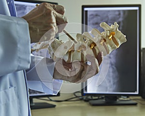 A neurosurgeon pointing at nerve root of lumbar vertebra model