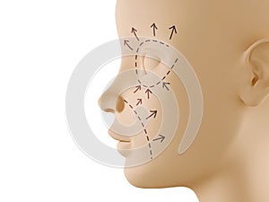 Neutral face profile with aesthetic surgery sign