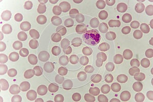 Neutrophil cell