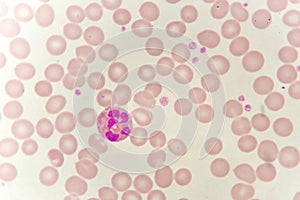 Neutrophil cell