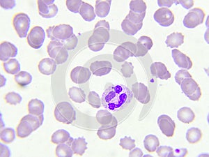 Neutrophil cell