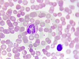 Neutrophil cell