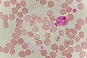 Neutrophil cell in blood smear