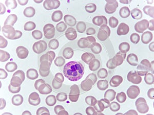 Neutrophil cell in blood smear