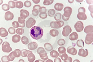 Neutrophil cell in blood smear