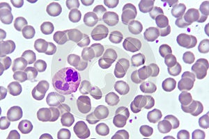 Neutrophil cell in blood smear