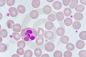 Neutrophil cell in blood smear