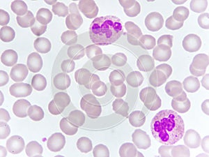 Neutrophil cell in blood smear