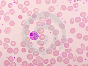 Neutrophil cell in blood smear