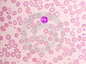 Neutrophil cell in blood smear photo