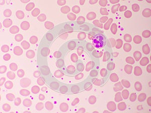 Neutrophil cell in blood smear photo