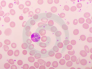 Neutrophil cell in blood smear photo
