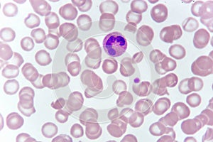 Neutrophil cell in blood smear photo