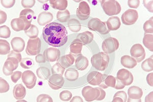 Neutrophil cell in blood smear photo