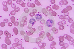 Neutrophil