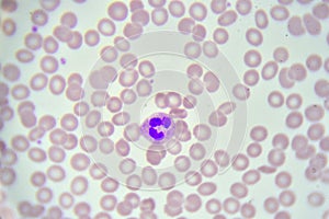 Neutrophil cell white blood cell in blood smear photo